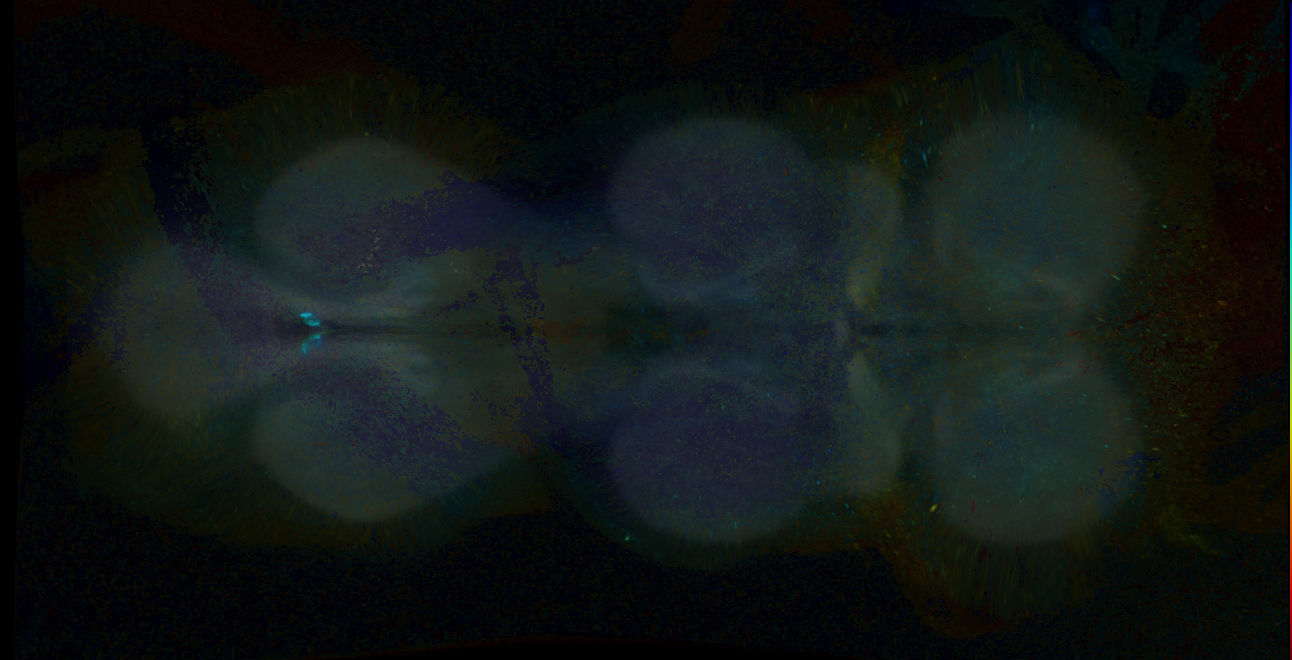 P{GMR18E05-GAL4} expression pattern