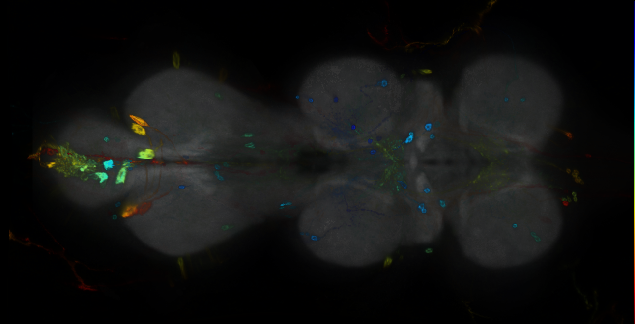 P{GMR18E06-GAL4} expression pattern