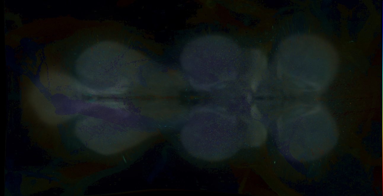 P{GMR18E09-GAL4} expression pattern