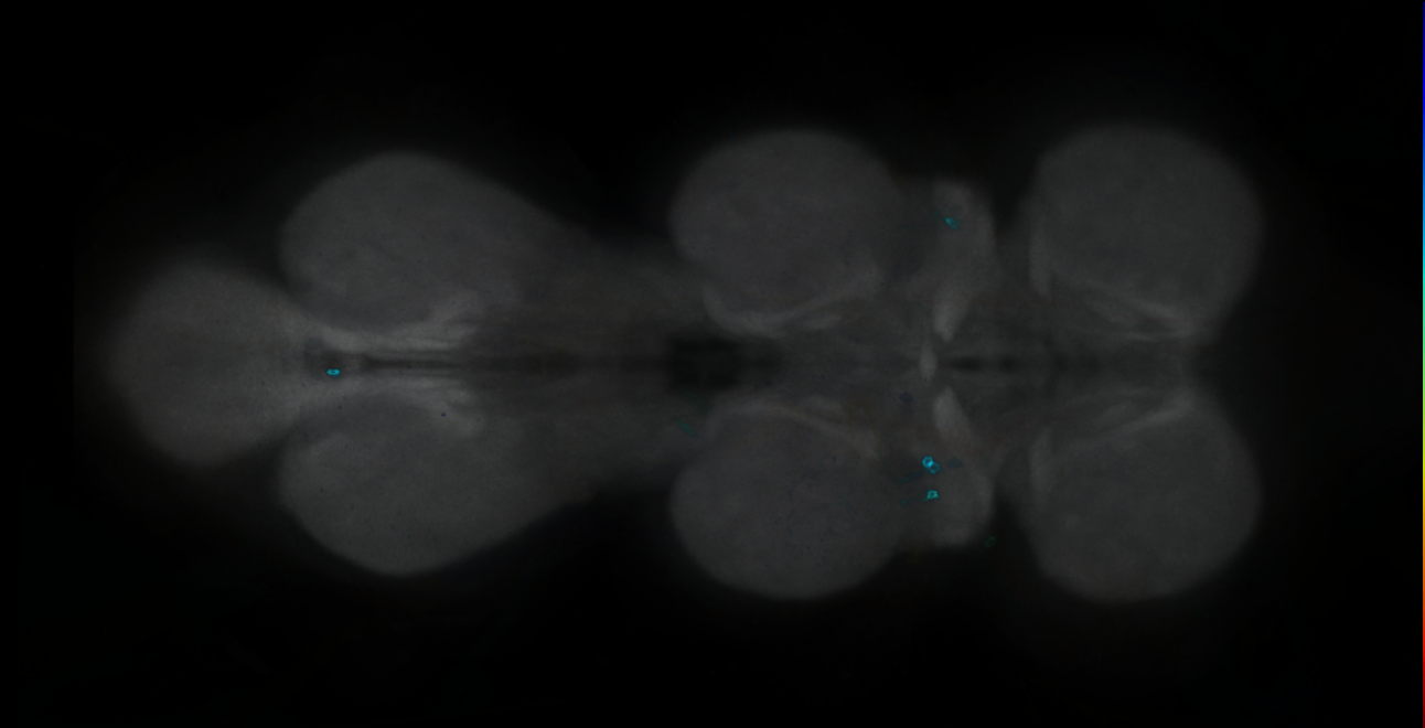 P{GMR18E11-GAL4} expression pattern
