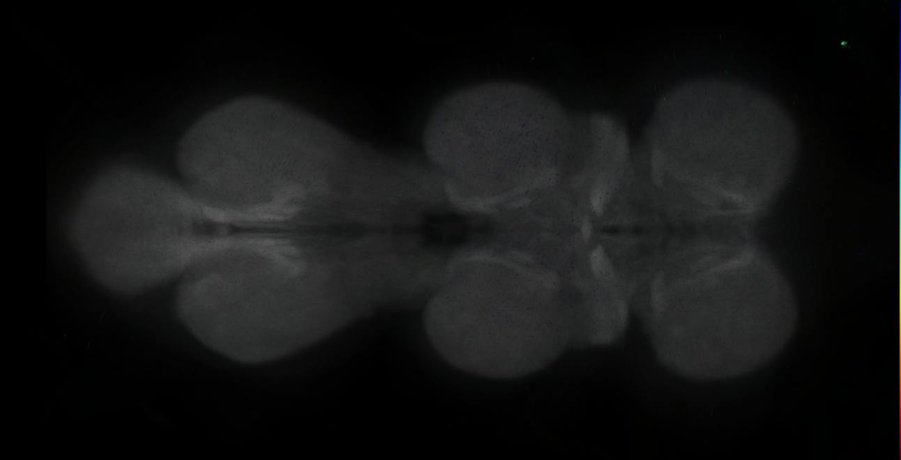 P{GMR18F05-GAL4} expression pattern