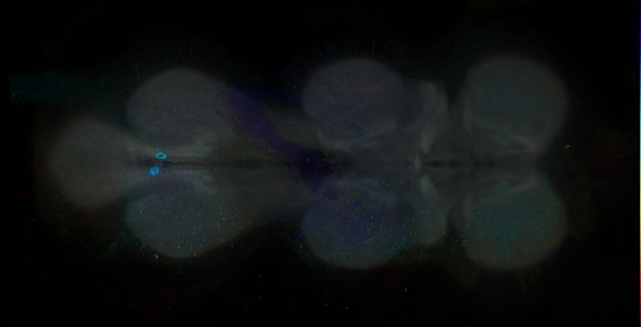 P{GMR18F06-GAL4} expression pattern