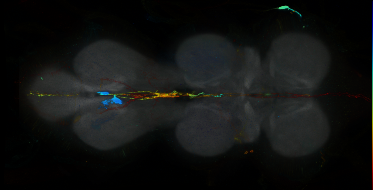 P{GMR18F10-GAL4} expression pattern