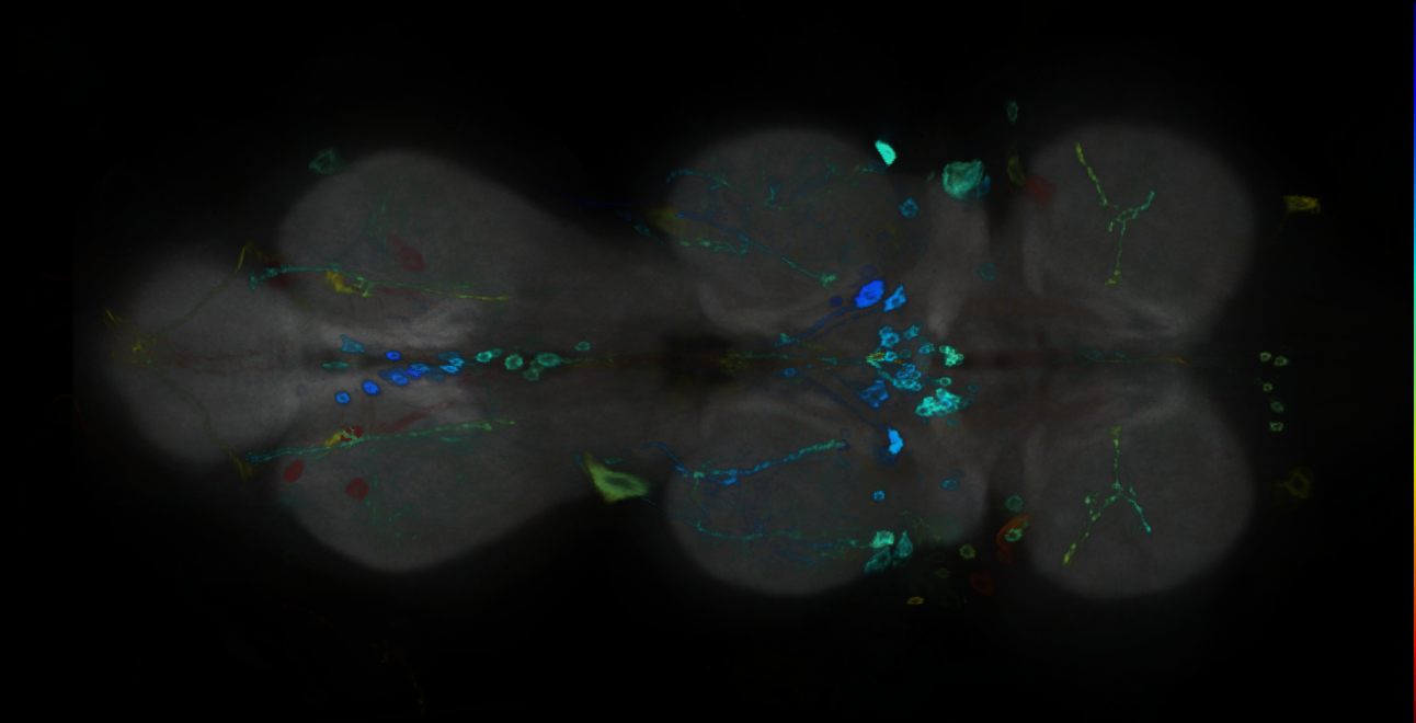 P{GMR18G01-GAL4} expression pattern