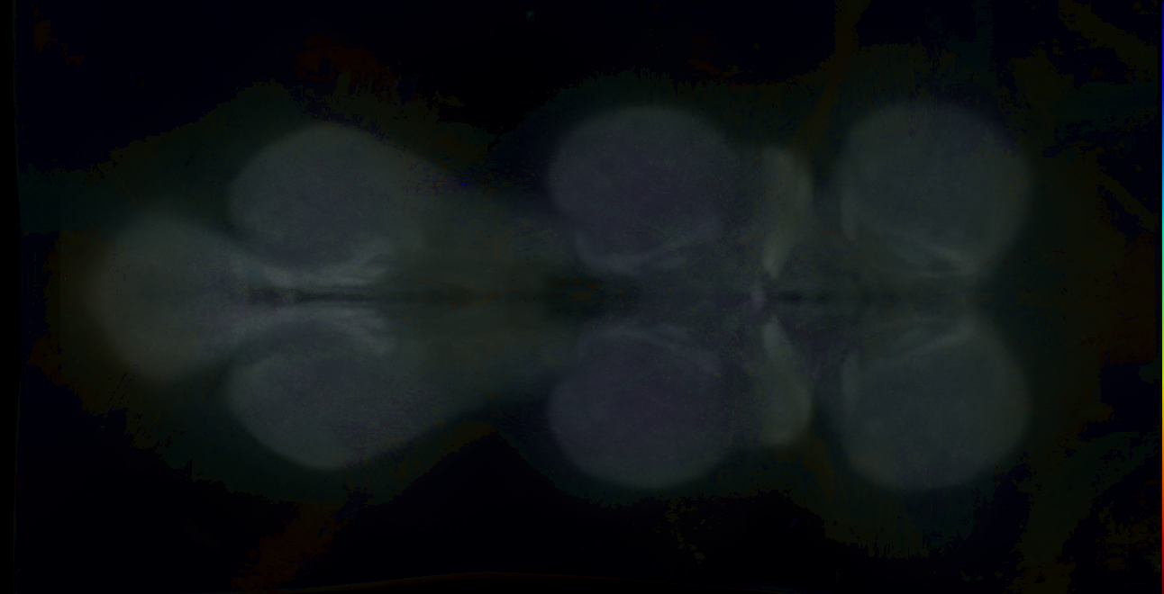 P{GMR18G03-GAL4} expression pattern