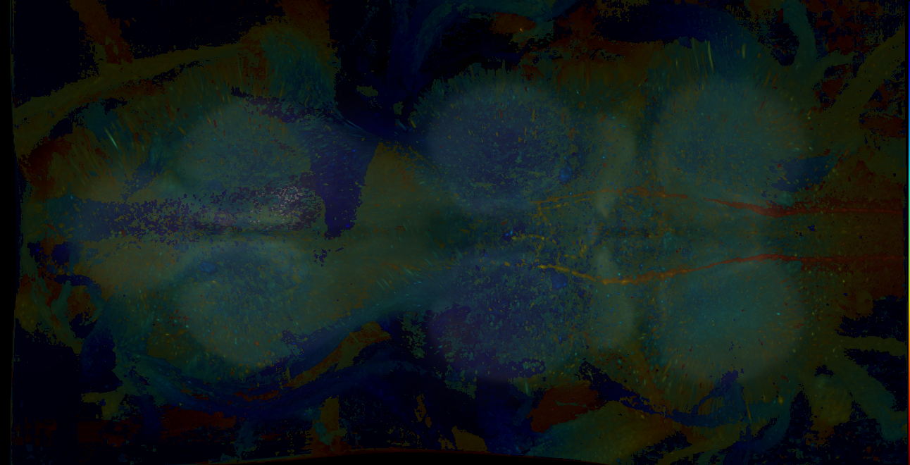 P{GMR18G04-GAL4} expression pattern