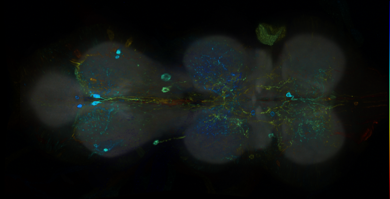 P{GMR18G05-GAL4} expression pattern