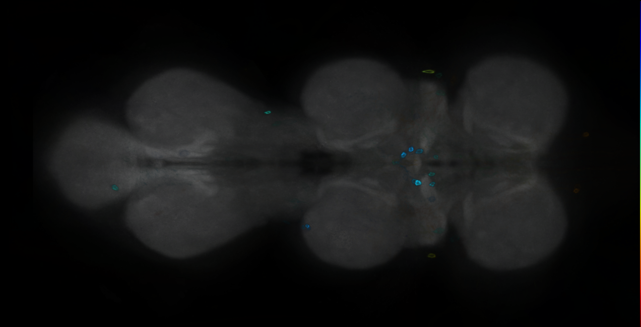 P{GMR18G06-GAL4} expression pattern