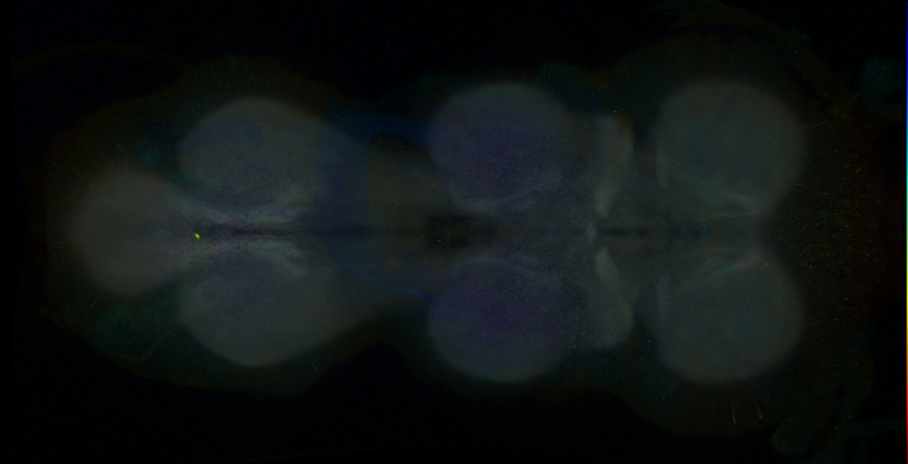 P{GMR18G09-GAL4} expression pattern