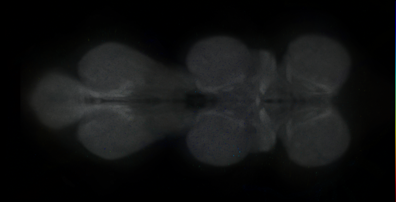 P{GMR18G11-GAL4} expression pattern