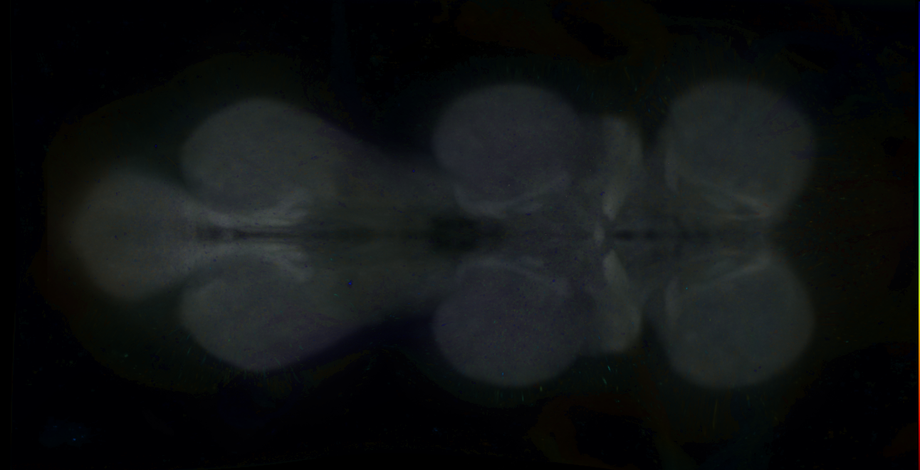P{GMR18G12-GAL4} expression pattern
