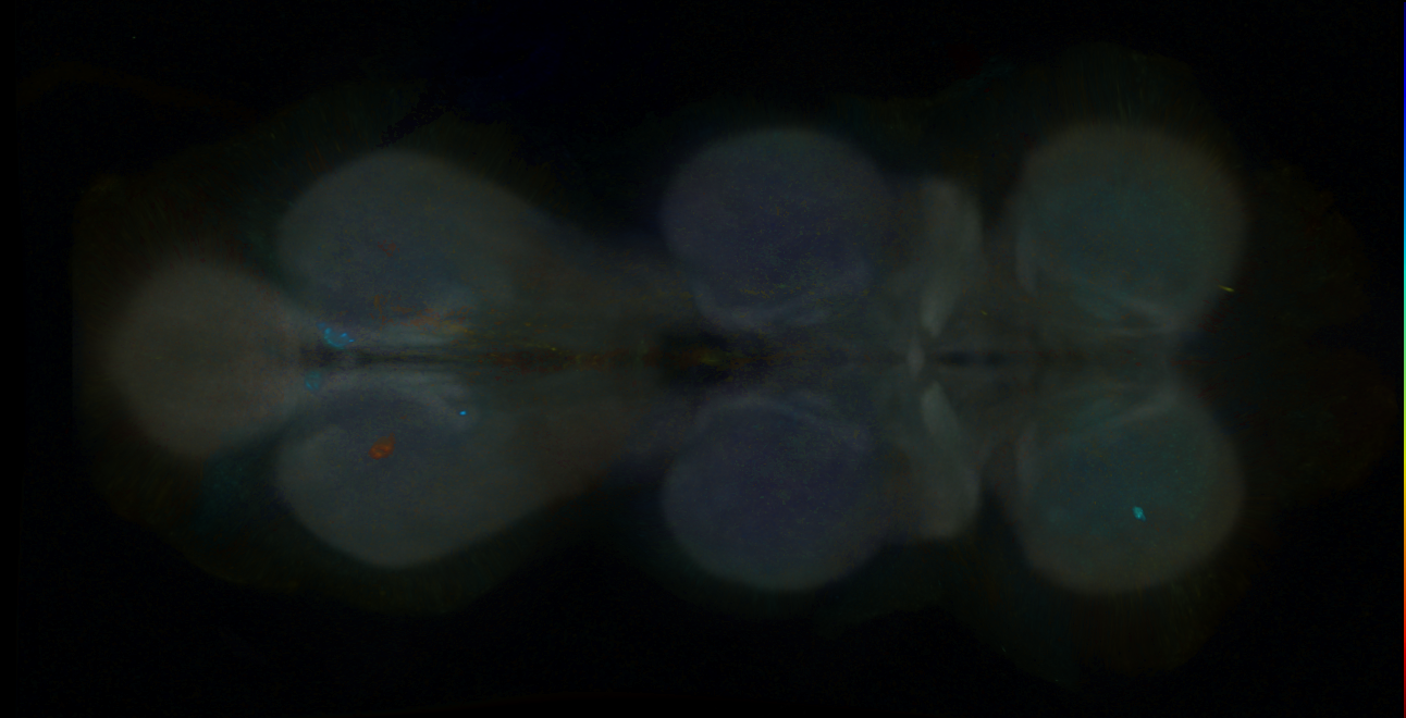 P{GMR18H06-GAL4} expression pattern