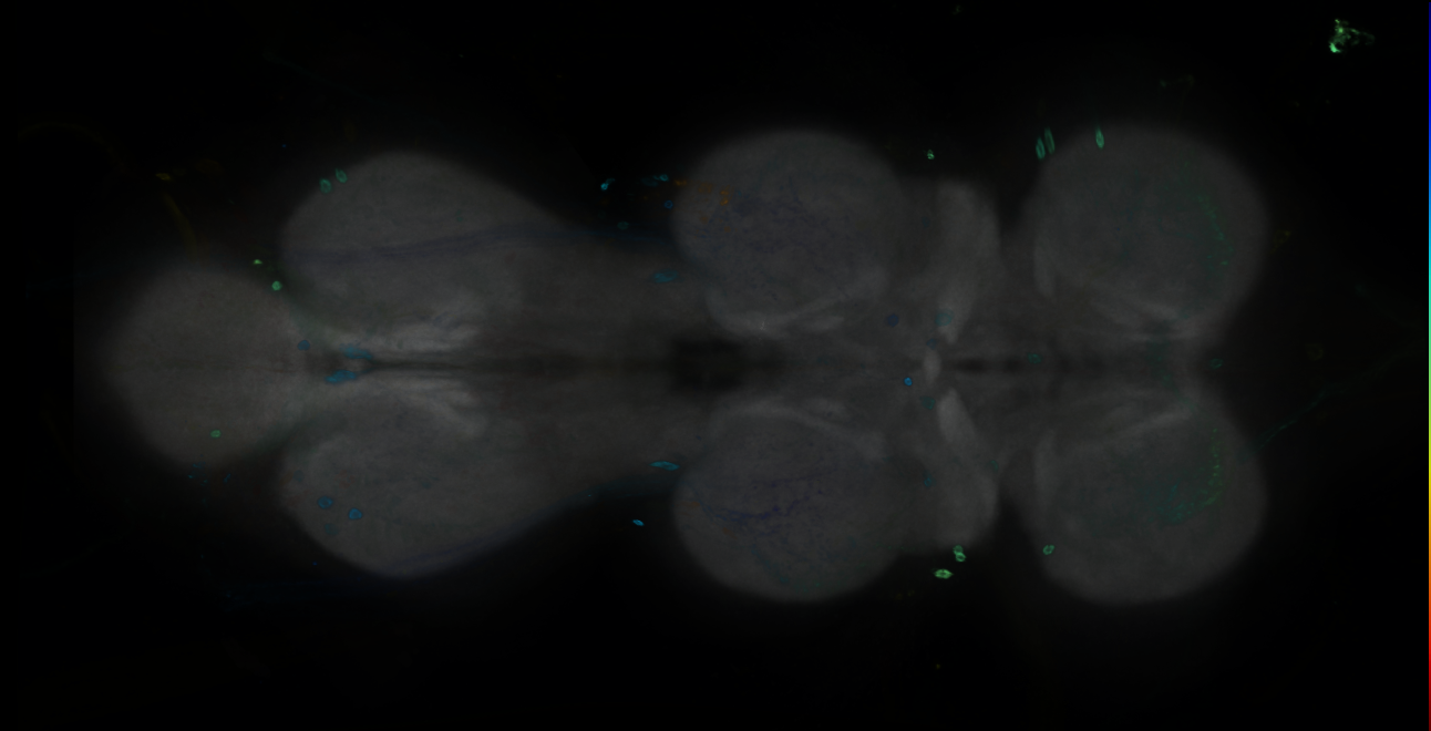 P{GMR18H10-GAL4} expression pattern
