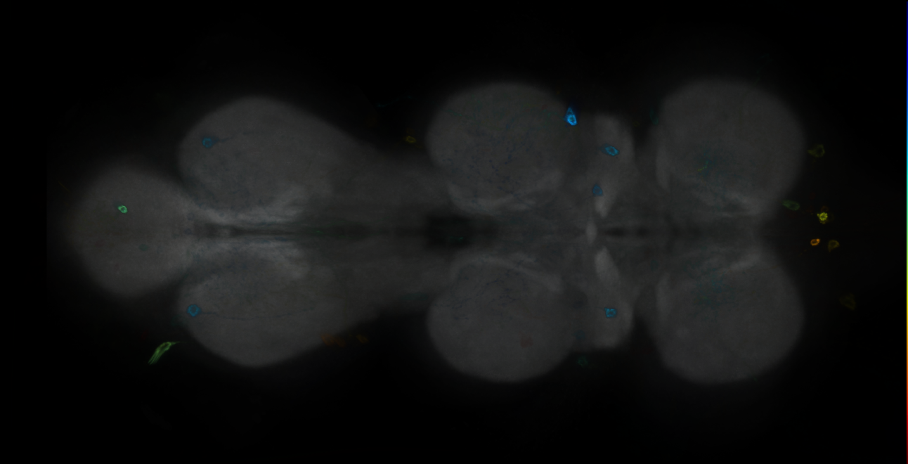 P{GMR18H11-GAL4} expression pattern