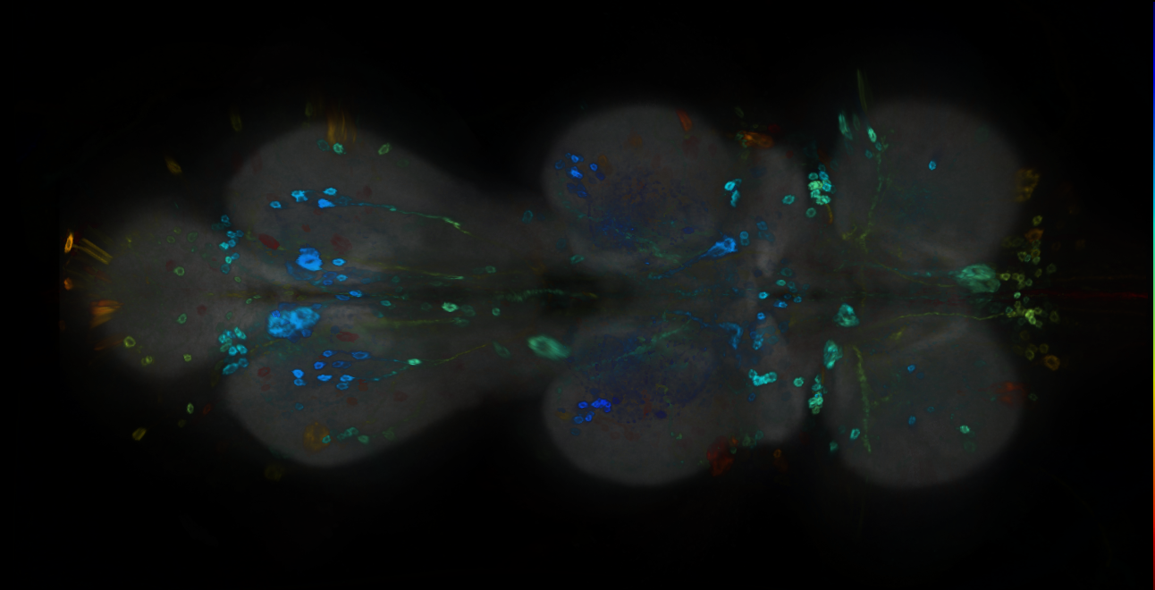 P{GMR19A01-GAL4} expression pattern