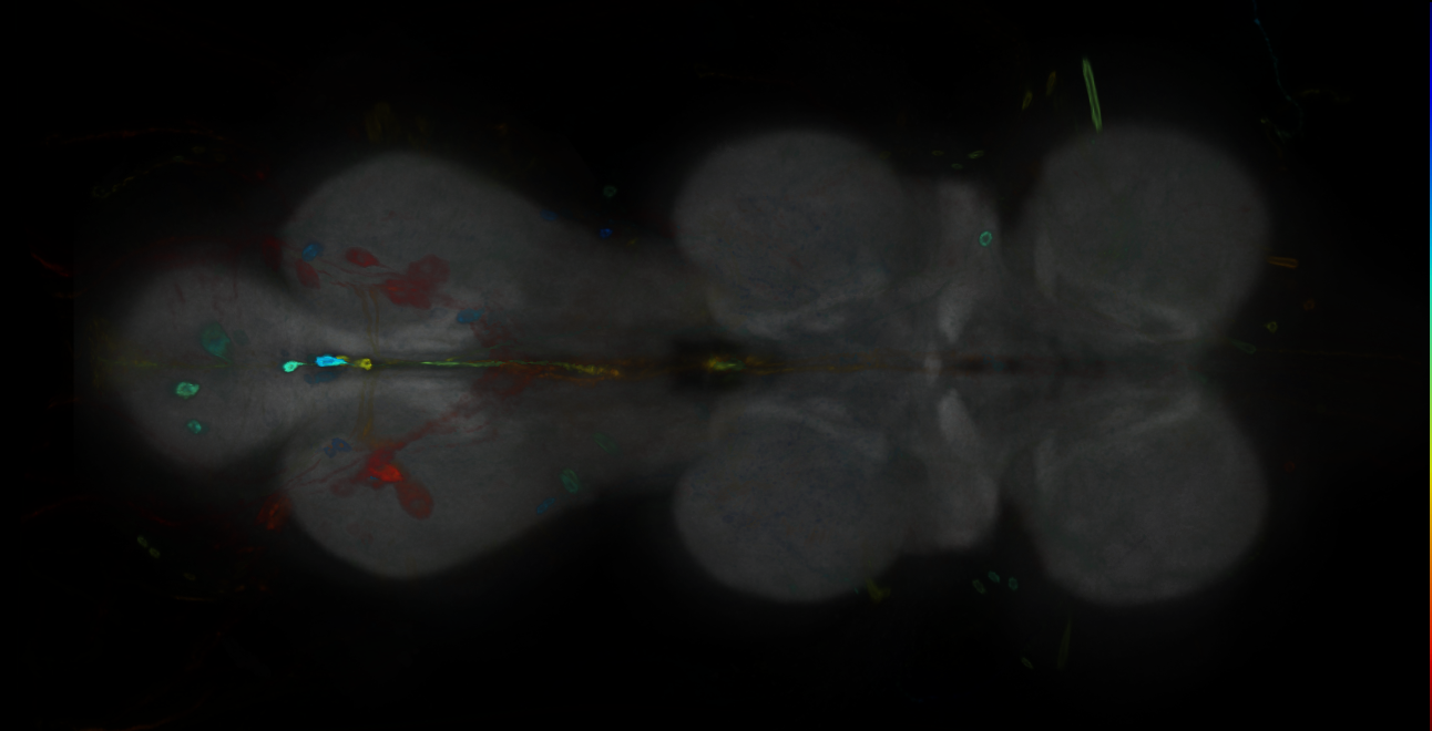 P{GMR19A04-GAL4} expression pattern