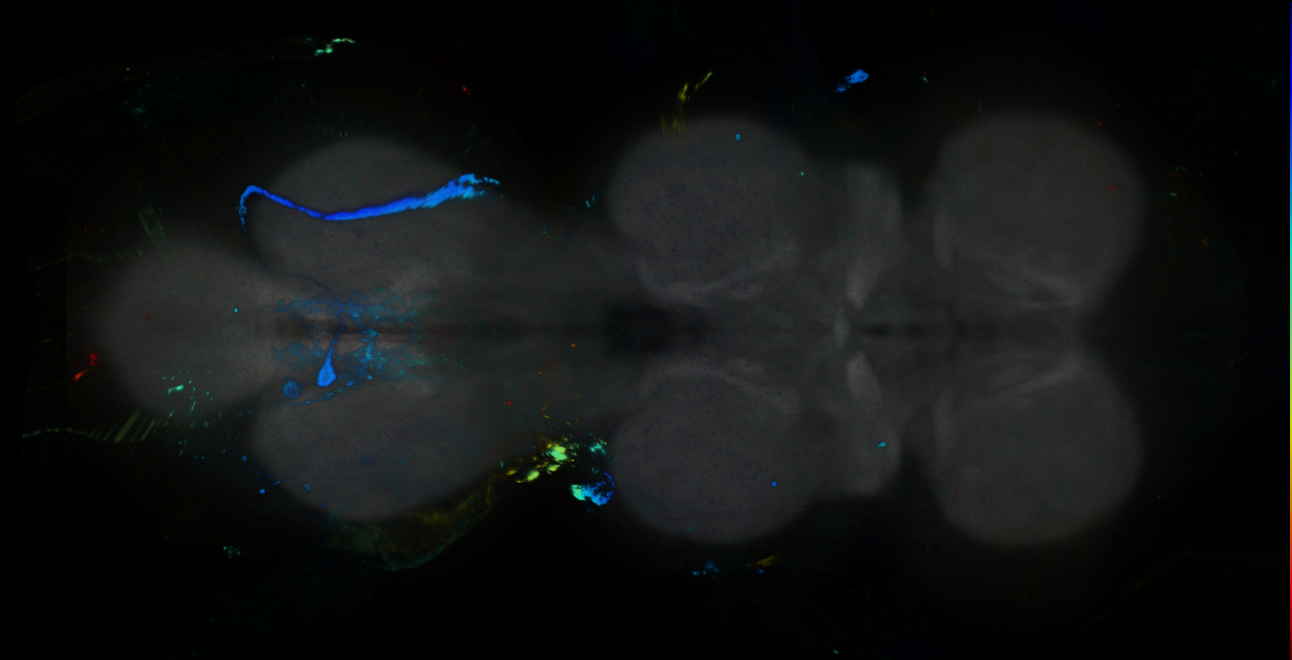 P{GMR19B04-GAL4} expression pattern