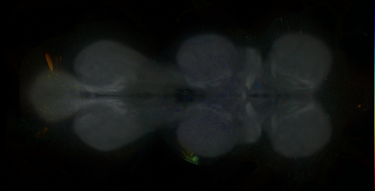 P{GMR19D04-GAL4} expression pattern