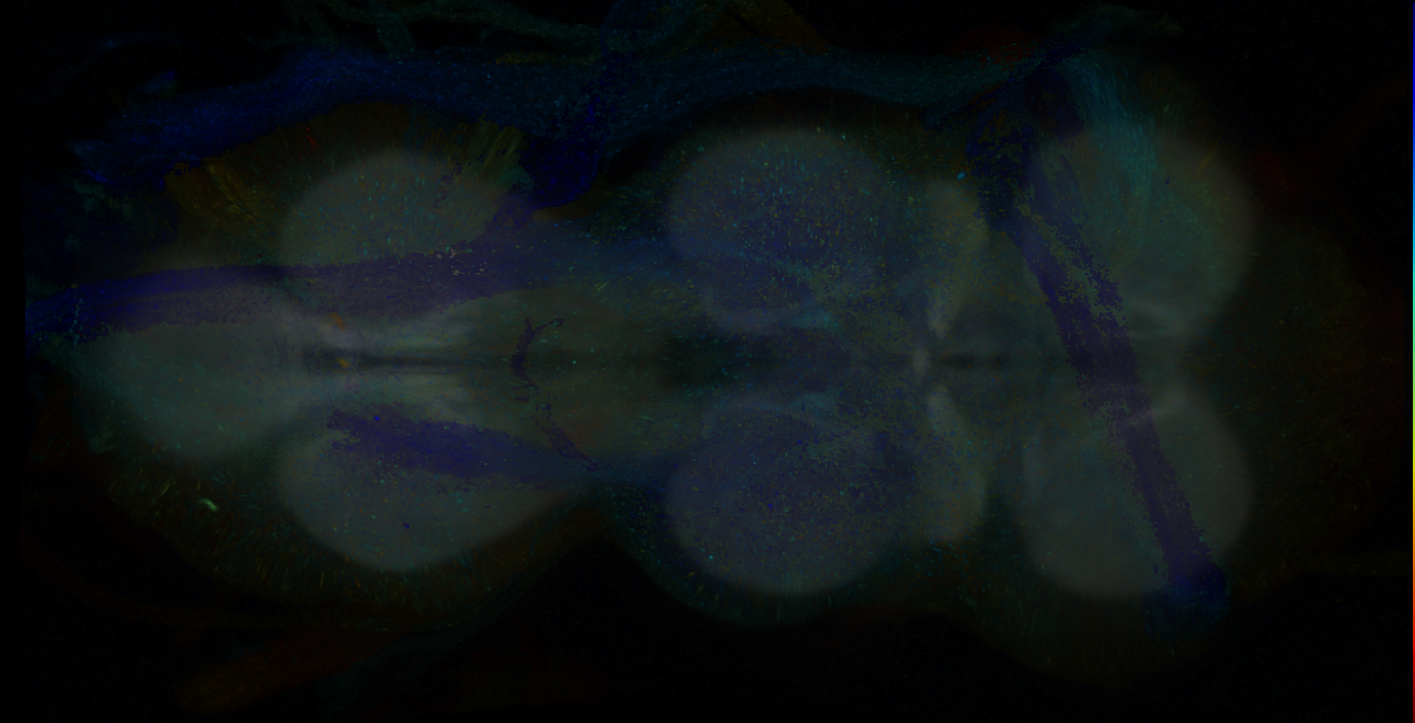 P{GMR19E03-GAL4} expression pattern