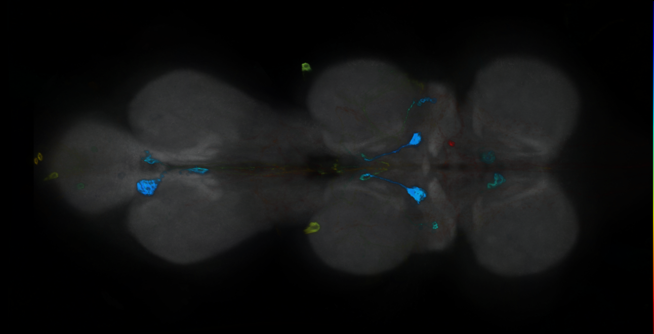 P{GMR19E06-GAL4} expression pattern