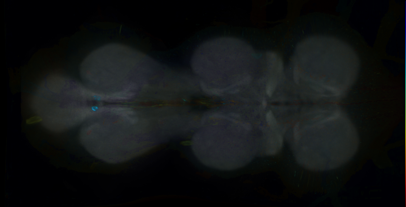 P{GMR19F03-GAL4} expression pattern