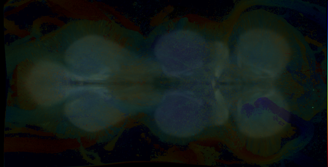 P{GMR19F07-GAL4} expression pattern