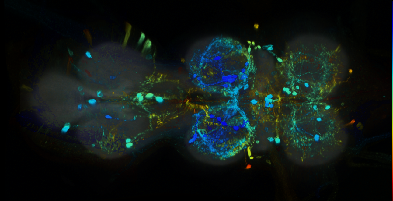 P{GMR19F12-GAL4} expression pattern