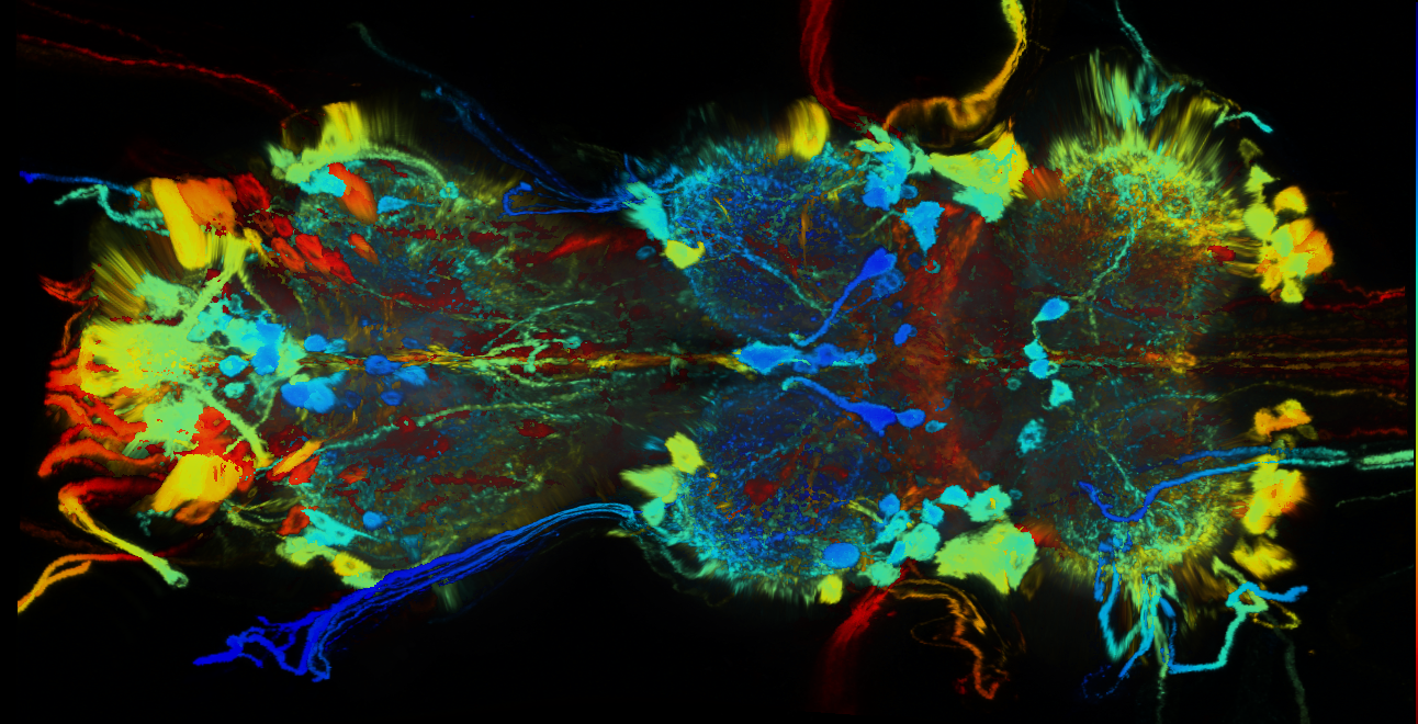 P{GMR19G04-GAL4} expression pattern