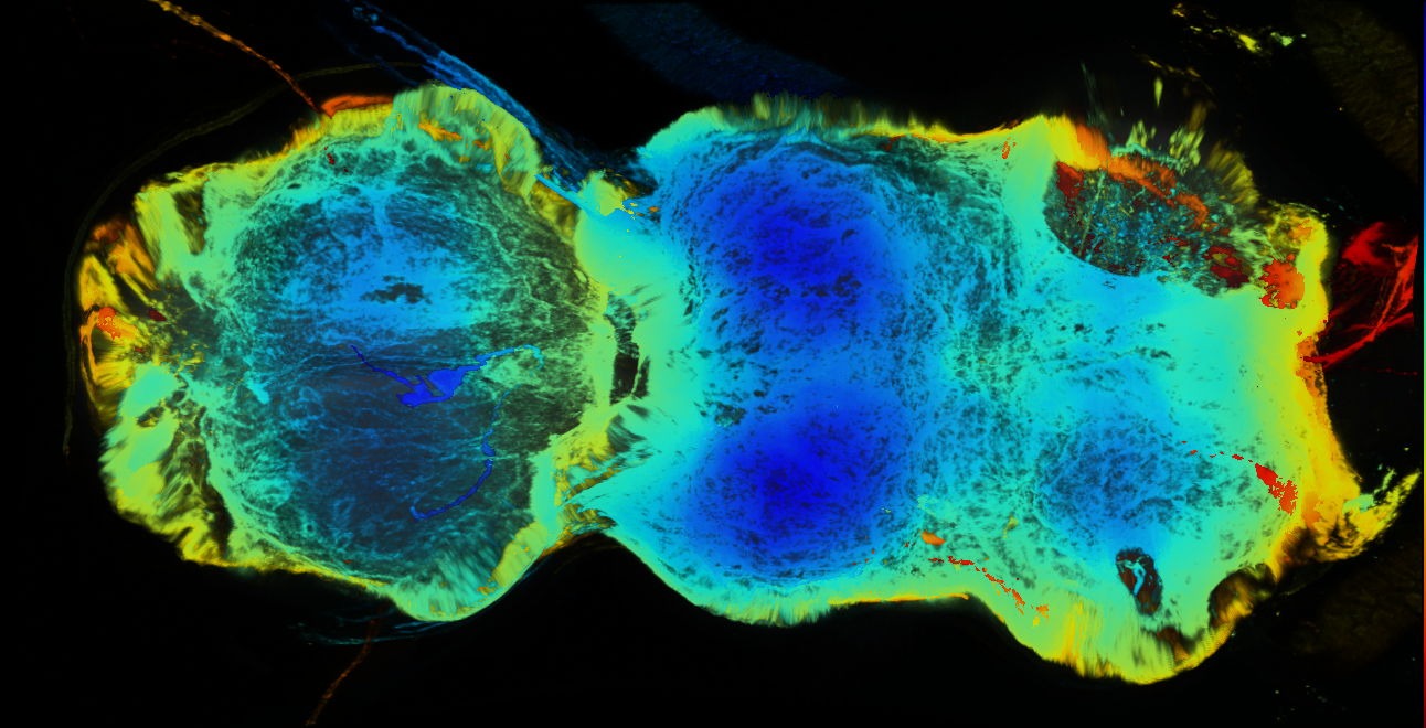 P{GMR19G08-GAL4} expression pattern