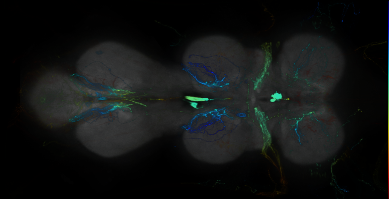 P{GMR19G10-GAL4} expression pattern