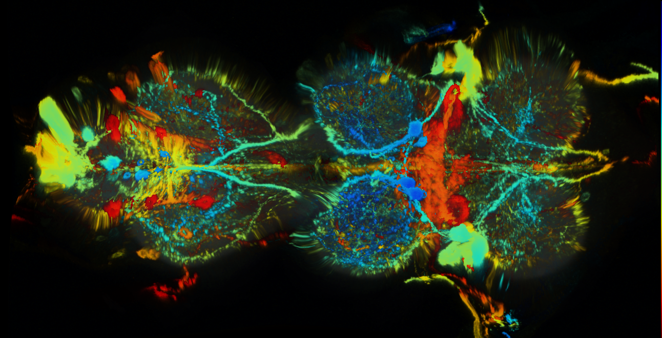 P{GMR19G12-GAL4} expression pattern