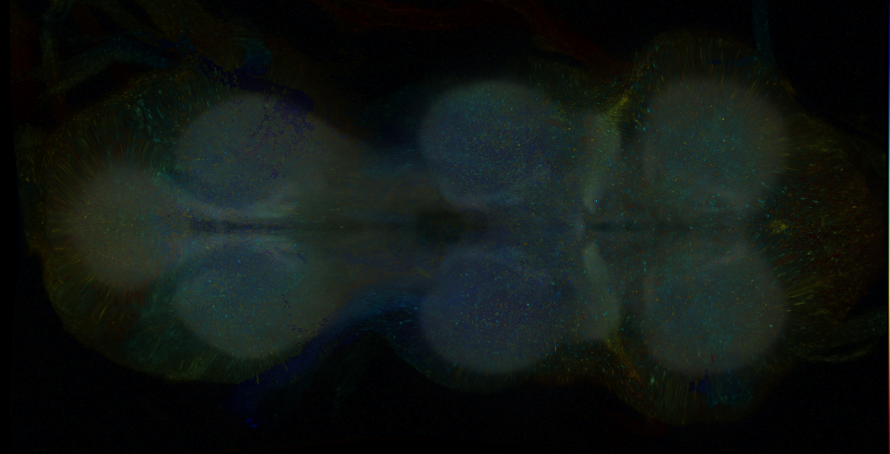 P{GMR19H03-GAL4} expression pattern