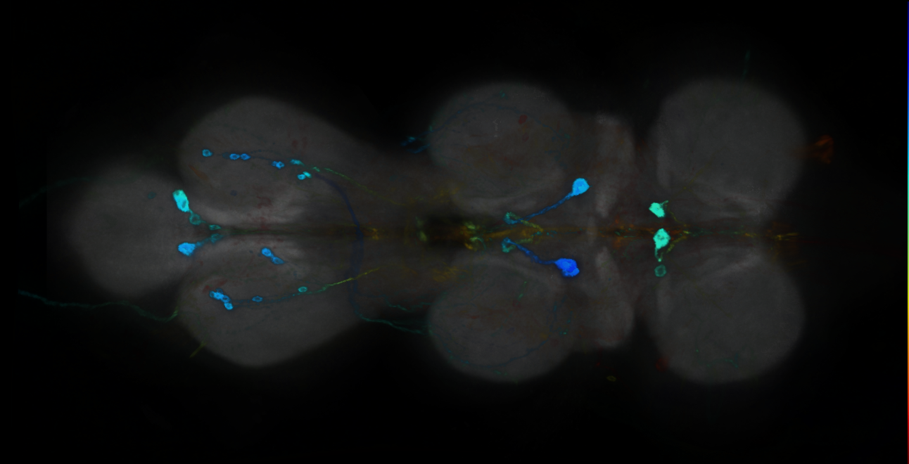P{GMR19H04-GAL4} expression pattern