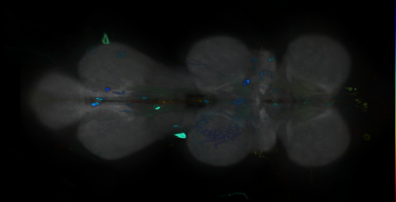 P{GMR19H07-GAL4} expression pattern