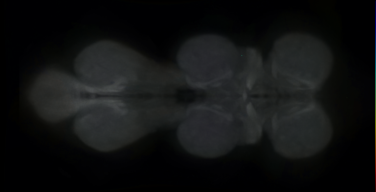 P{GMR20A05-GAL4} expression pattern
