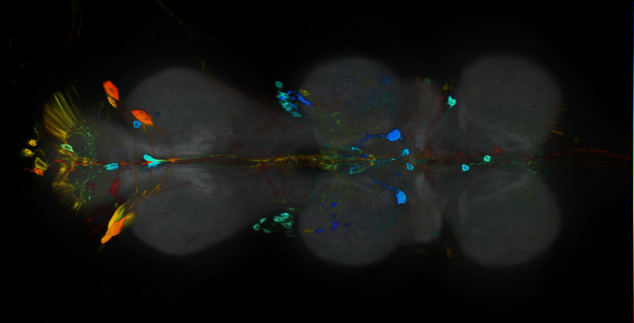 P{GMR20A08-GAL4} expression pattern
