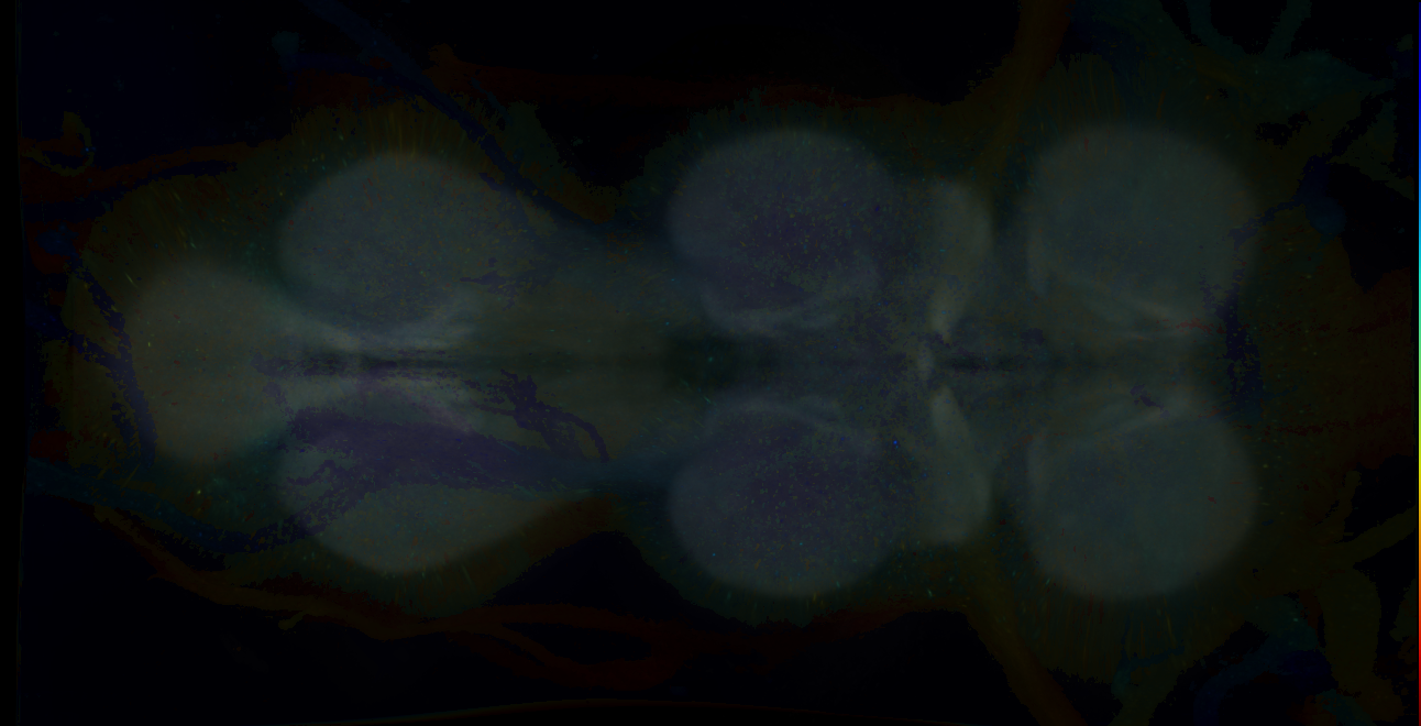 P{GMR20B04-GAL4} expression pattern