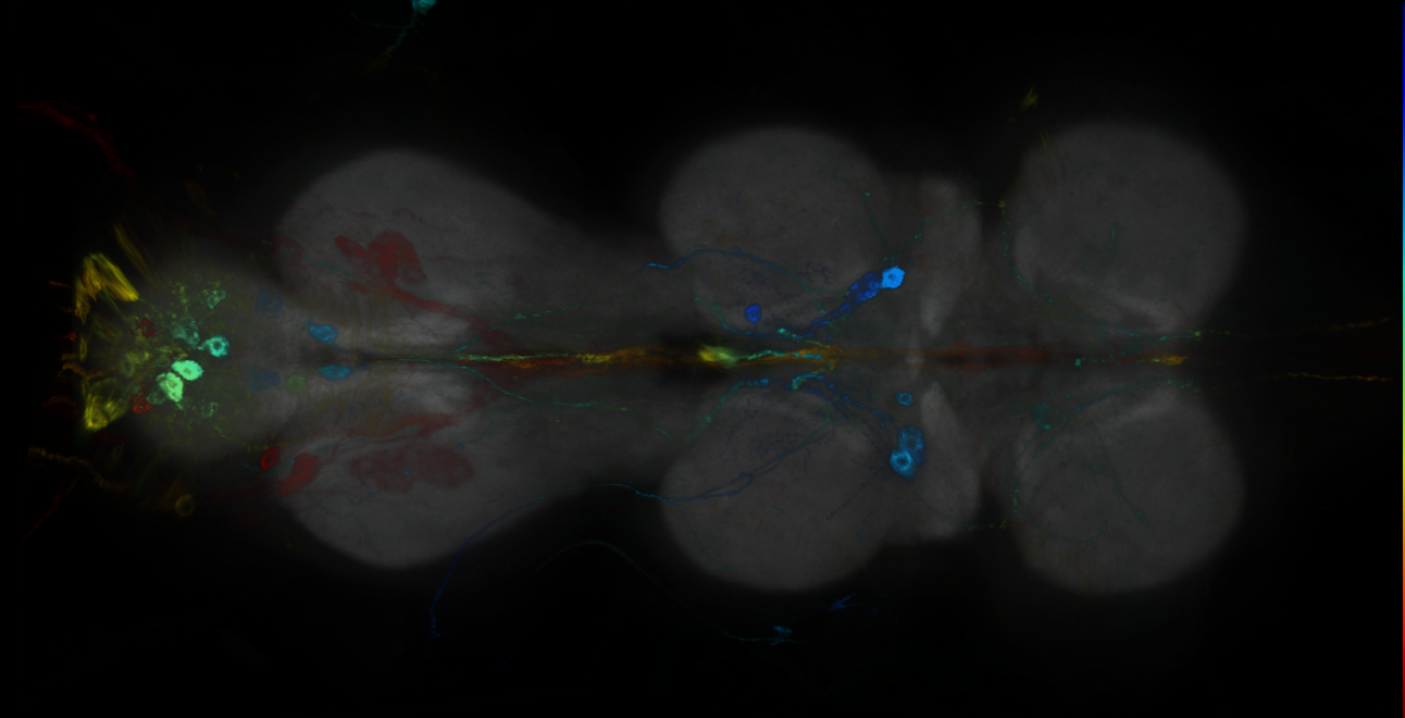 P{GMR20B08-GAL4} expression pattern