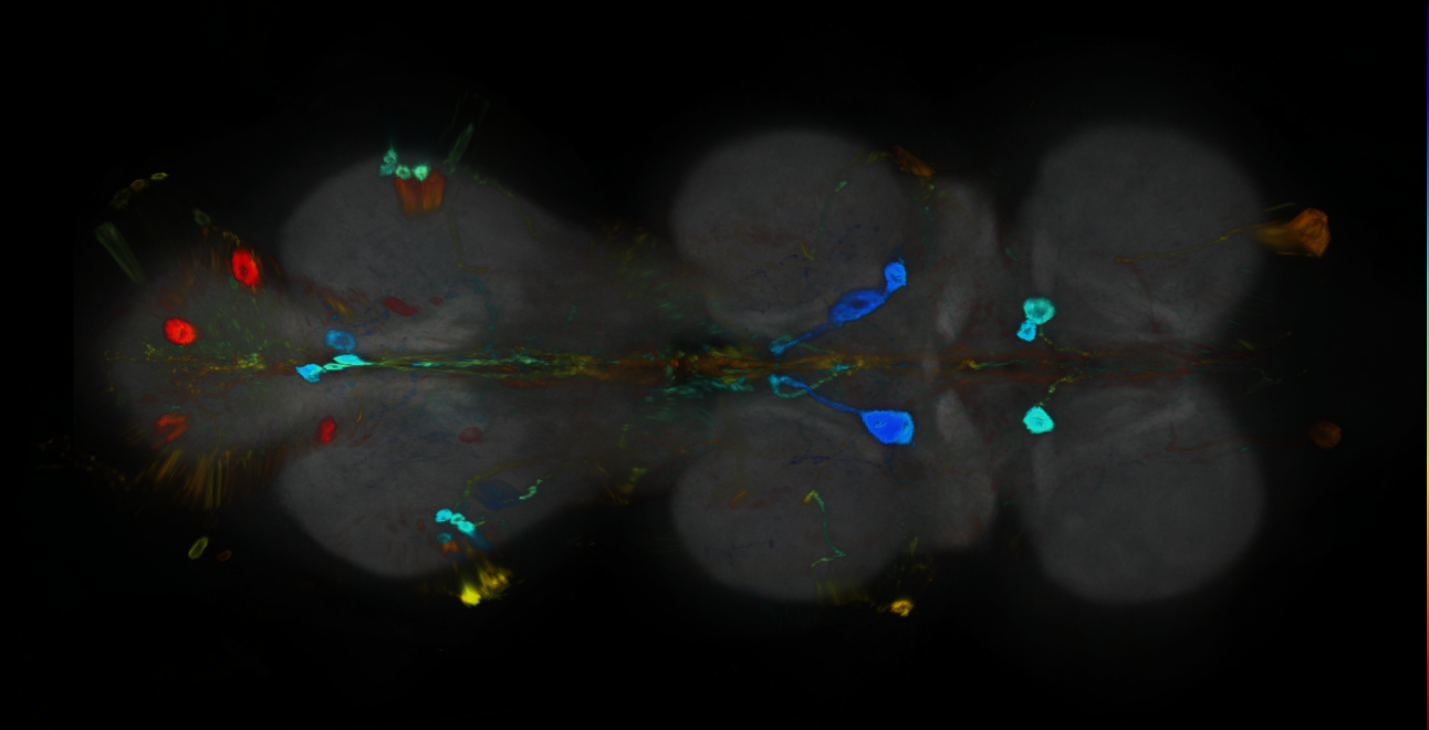 P{GMR20B09-GAL4} expression pattern