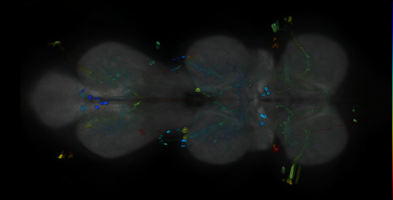 P{GMR20D06-GAL4} expression pattern
