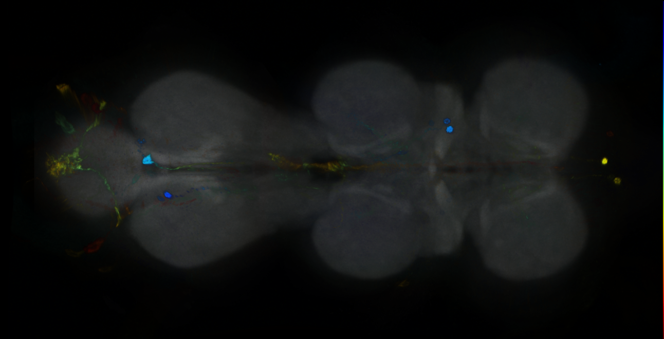 P{GMR20G05-GAL4} expression pattern
