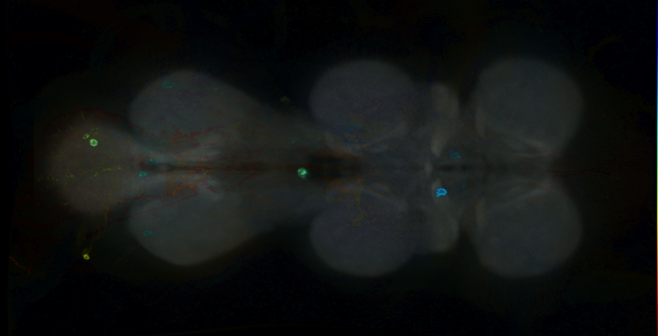 P{GMR20G07-GAL4} expression pattern