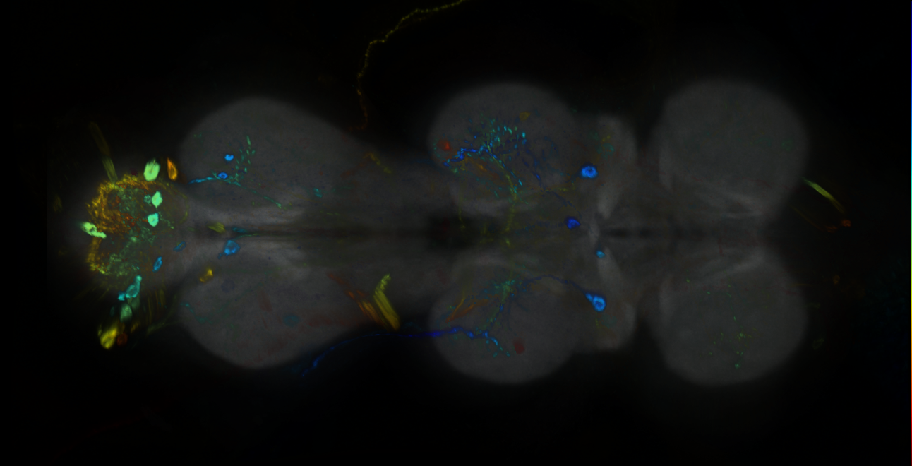 P{GMR20G10-GAL4} expression pattern