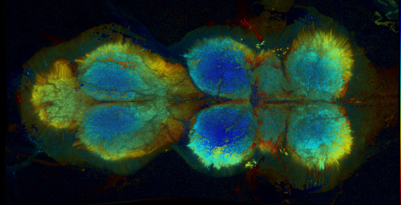 P{GMR20H02-GAL4} expression pattern