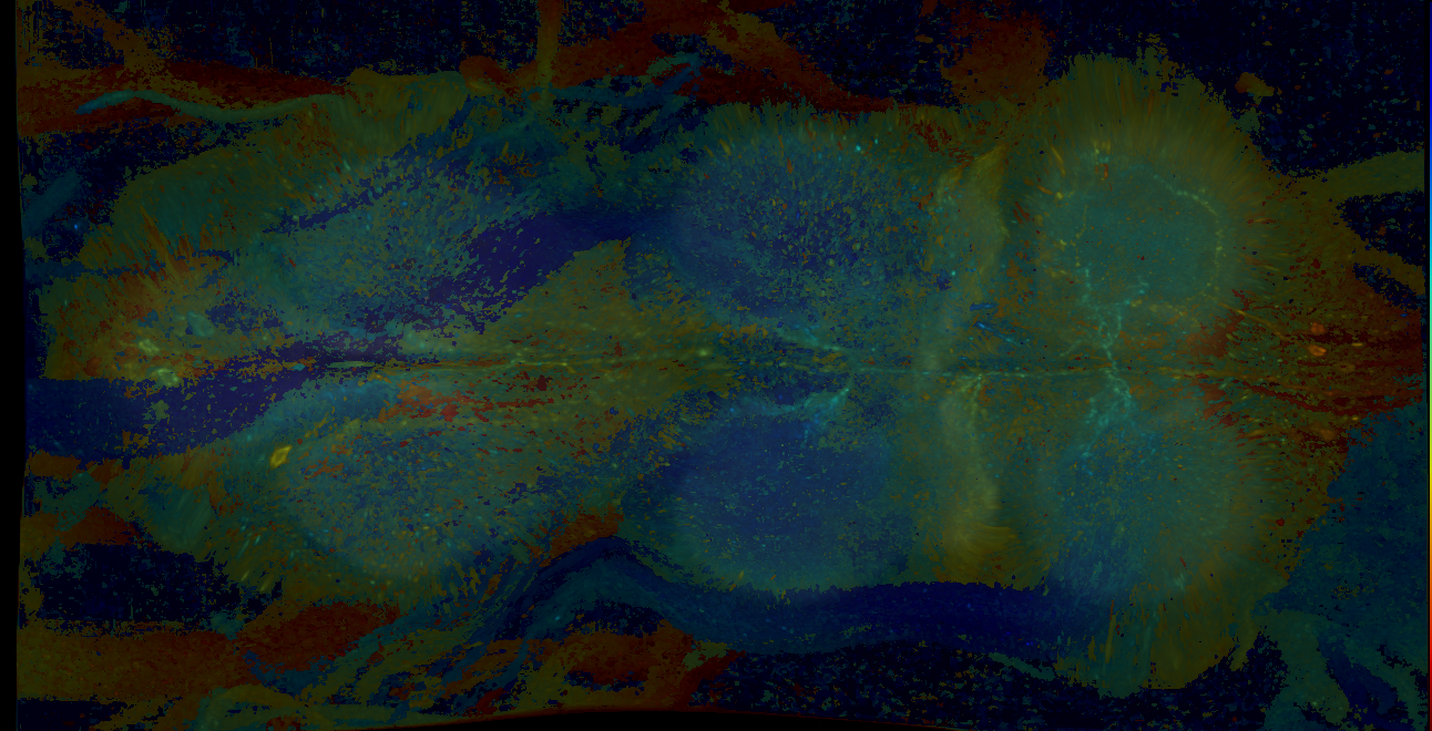 P{GMR20H08-GAL4} expression pattern