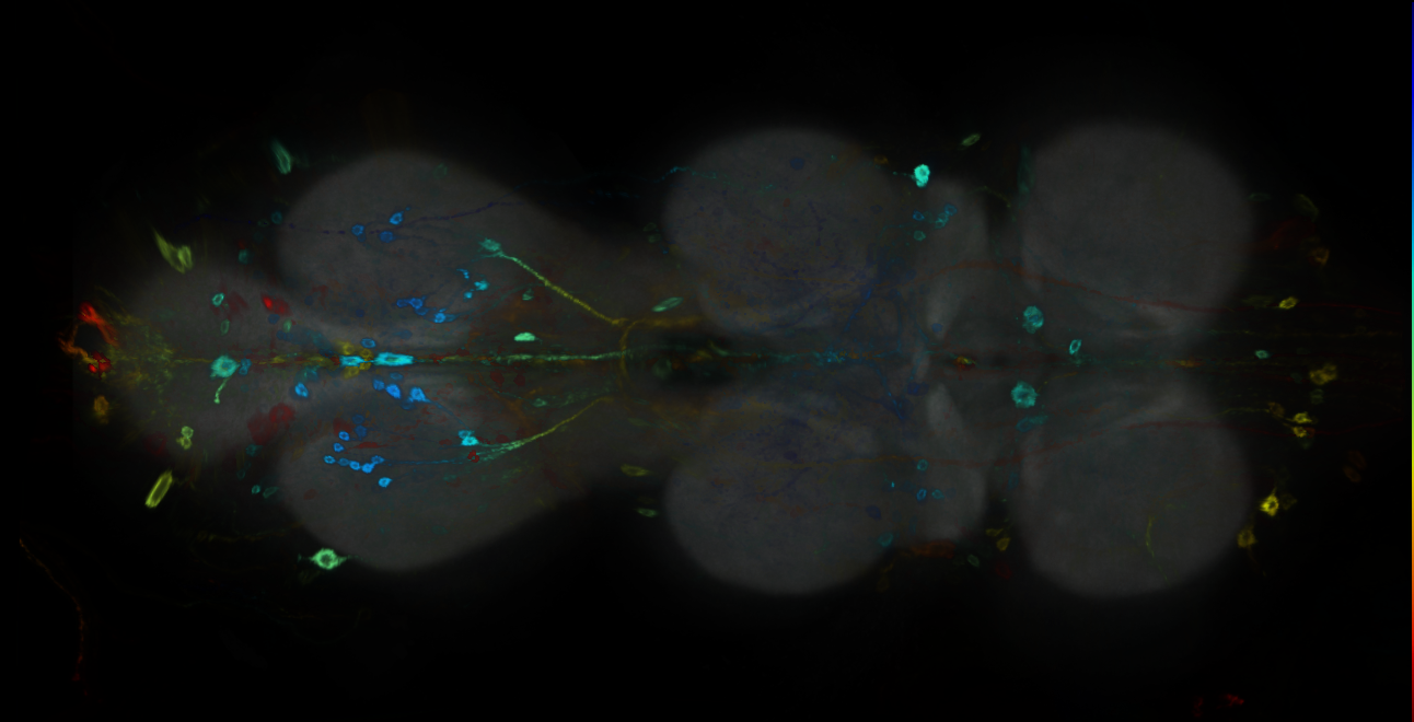 P{GMR20H10-GAL4} expression pattern