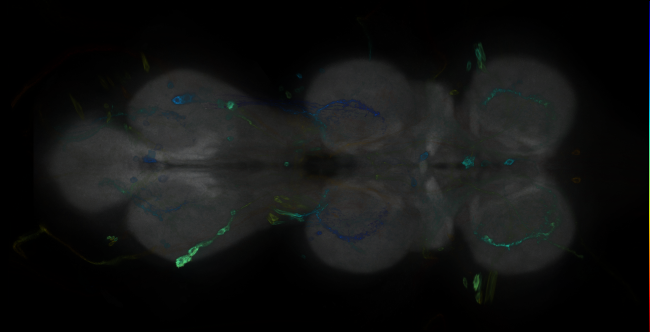 P{GMR20H11-GAL4} expression pattern
