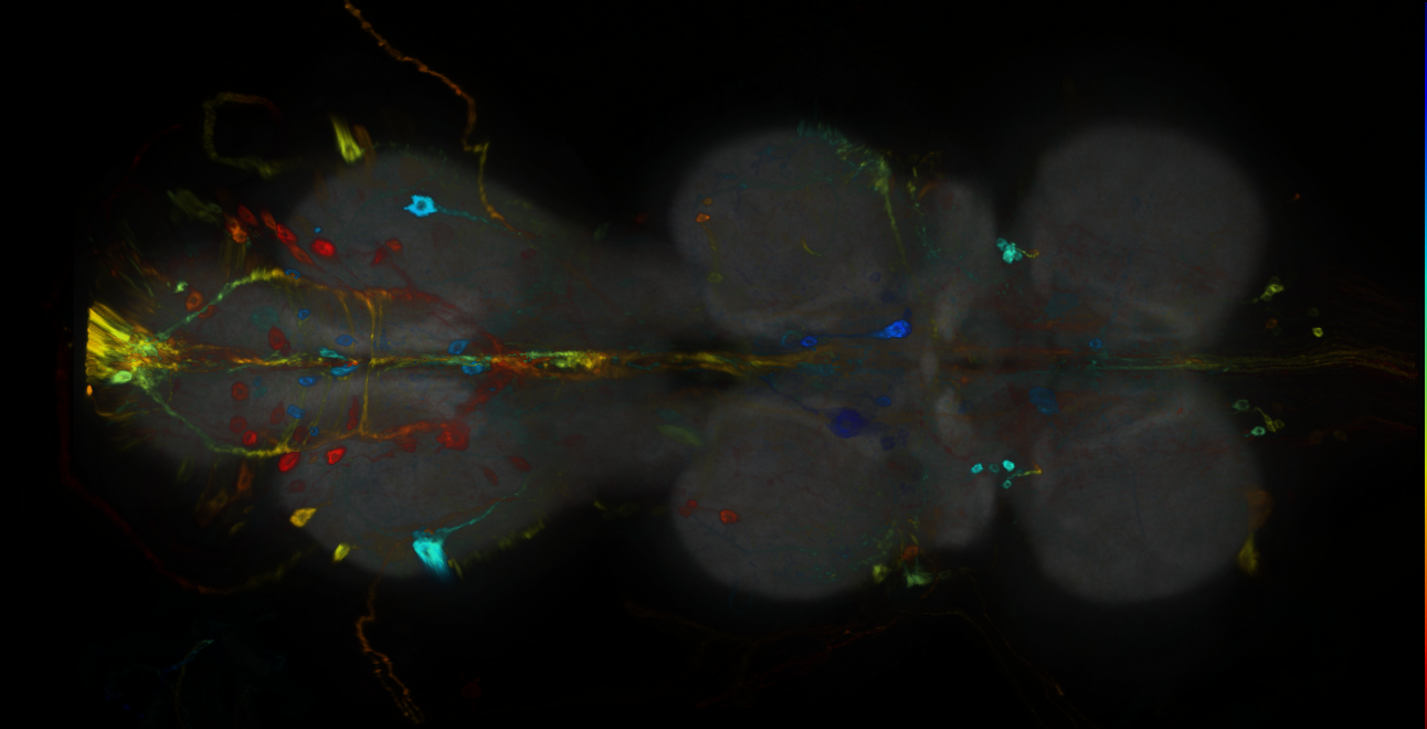 P{GMR21A02-GAL4} expression pattern