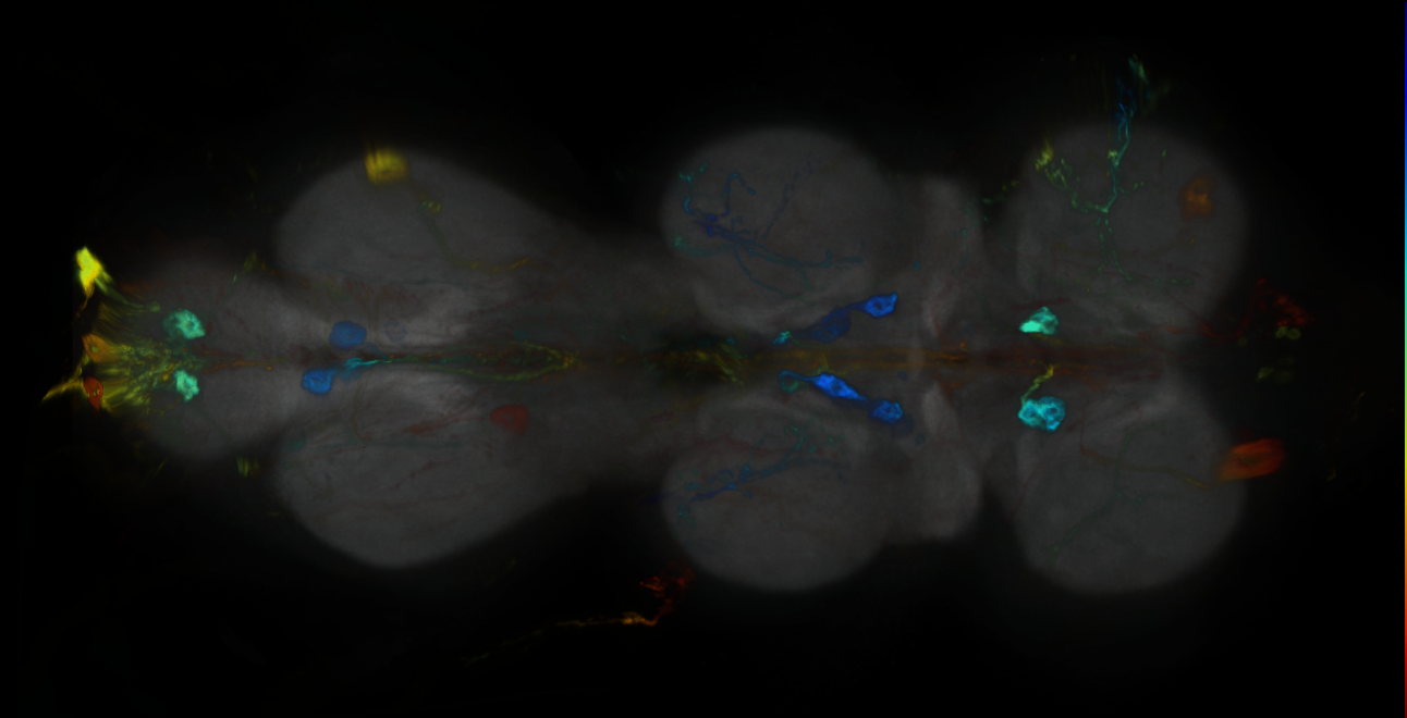 P{GMR21A11-GAL4} expression pattern
