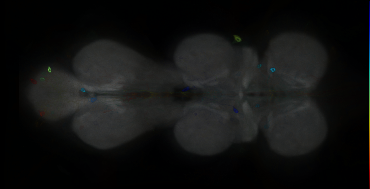 P{GMR21C08-GAL4} expression pattern